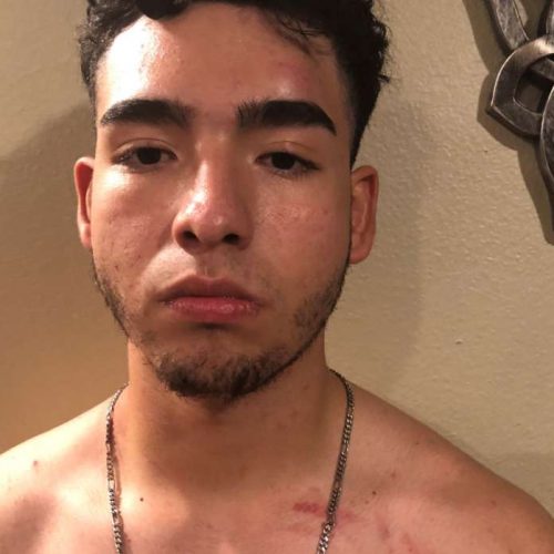 Teen Files Suit After Being Beaten by off-duty Baytown Officer