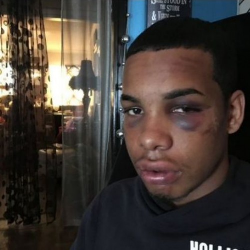 NJ Police Officer Arrested And Charged For Beating Black Teen