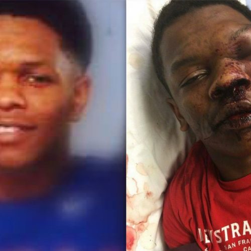 No Charges For Alabama Cops Who Hospitalized Man With Multiple Injuries
