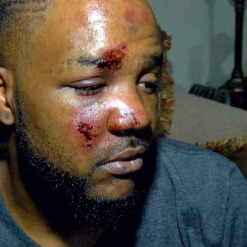 Two Mississippi Police Officers Fired After Repeatedly Kicking Man in Face During Arrest