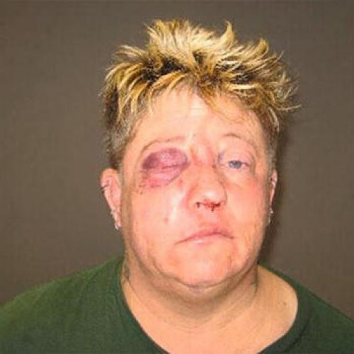 Minnesota Officer Charged With Assaulting Handcuffed Woman, Fracturing a Bone in Her Face